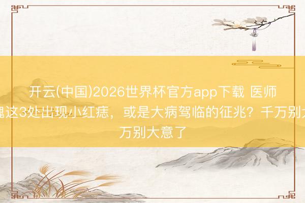 开云(中国)2026世界杯官方app下载 医师：体魄这3处出现小红痣，或是大病驾临的征兆？千万别大意了